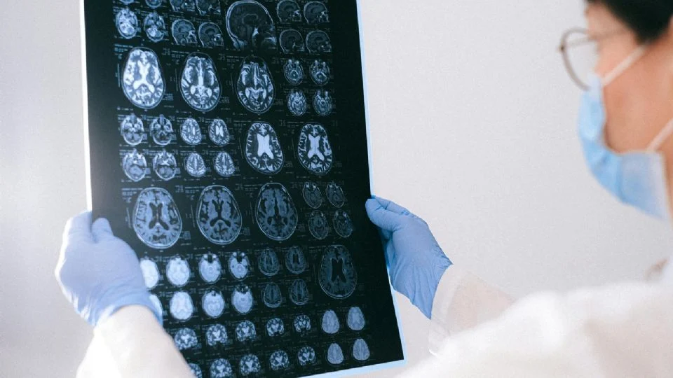 Reinicialização cerebral: Alzheimer é revertido em camundongos com tratamento inovador, apontam cientistas